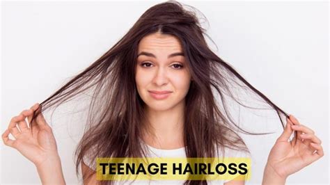 Teenage Hair Loss and Thinning: Symptoms, Causes, Treatment.